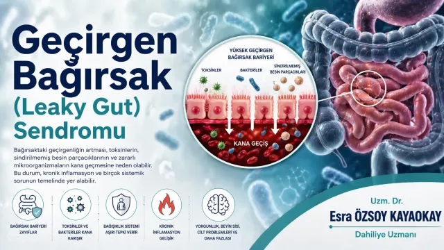 Geçirgen Bağırsak (Leaky Gut) Sendromu