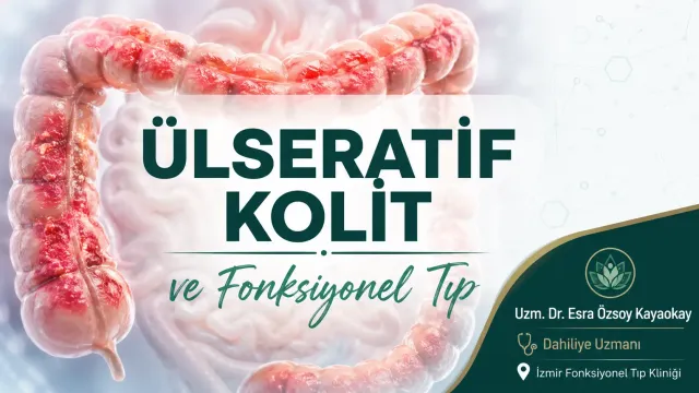 Ülseratif Kolit Hastalığında Fonksiyonel Tıp Yaklaşımı